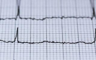 Cardio IQ Test Reveals Hidden Heart Disease Risks - InOut Labs