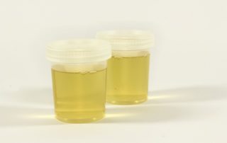 Shy Bladder DOT Drug Test - InOut Labs