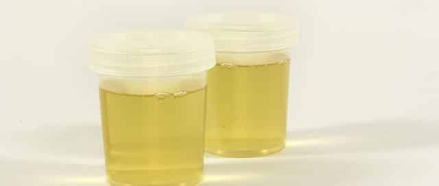 Shy Bladder DOT Drug Test - InOut Labs