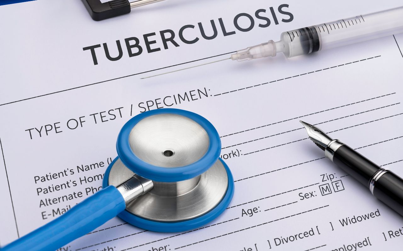 TB Testing